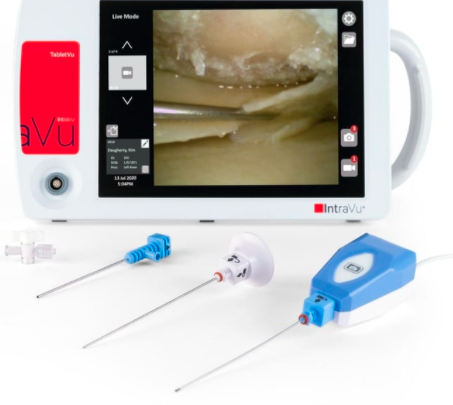 MIDASVu Arthroscope System (Prod 2108152